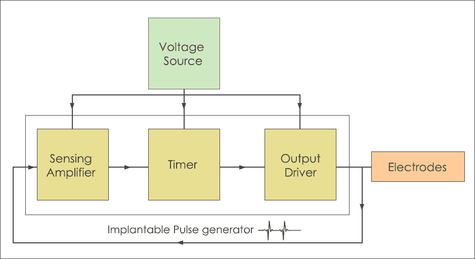 Pace Maker Operation-Medical Electronics