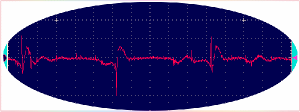 Avcc Noise